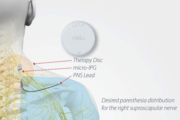 peripheral-nerve-stimulator small